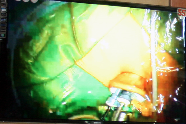 Cầu truyền hình y học đa điểm các bệnh viện quân đội chào mừng ngày khoa học và công nghệ Việt Nam